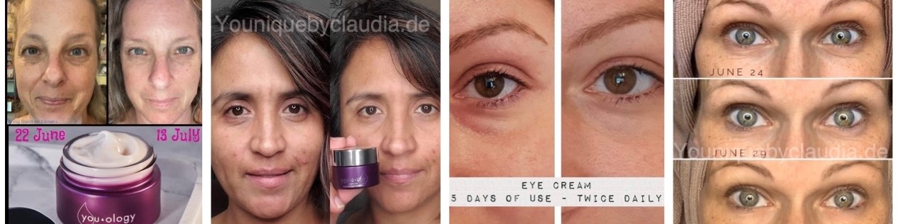 Younique Youology Augencreme Rosazea Rosacea Neurodermitis Schuppenflechte Couperose