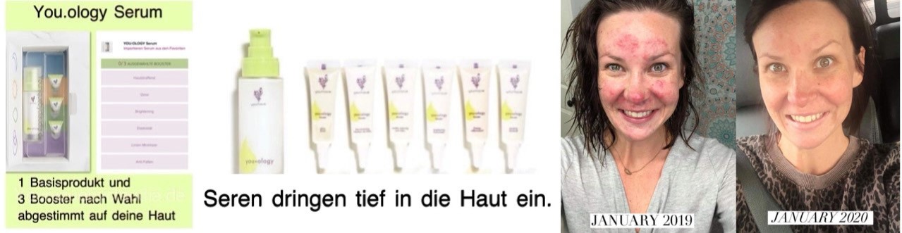 Younique Youology Serum 1 Rosazea Rosacea Neurodermitis Schuppenflechte Couperose