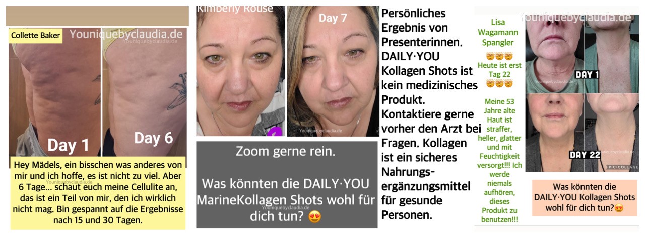 Younique Daily You Kollagen Cellulite persönliches Ergebnis