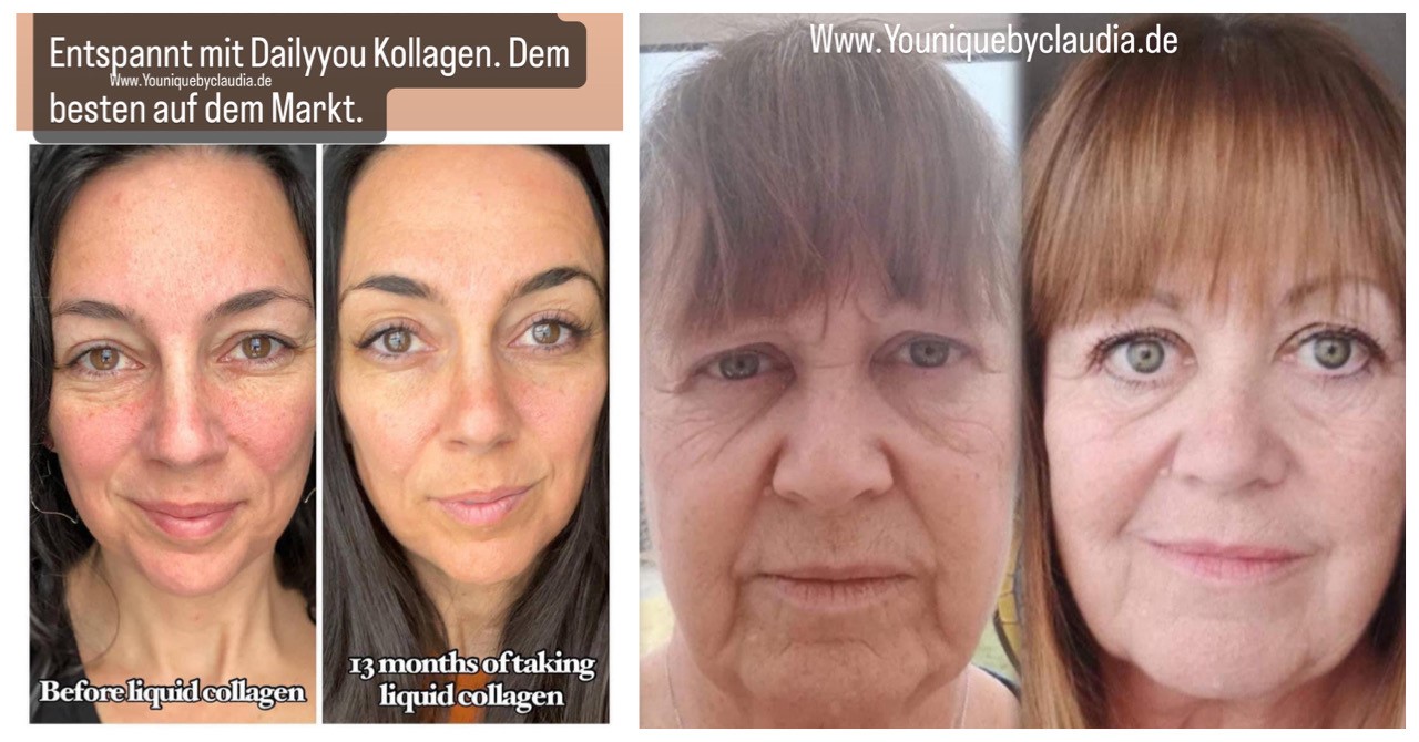 Younique Daily You Kollagen ab 59 Euro günstiger im Abonnement
